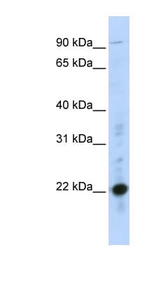 CRIP2 Antibody (C-Terminus)