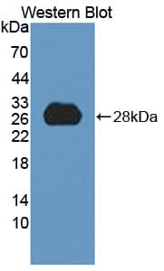 ARP5 / ANGPTL6 Antibody (aa257-470)