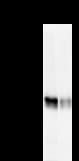 Monoclonal Mouse anti-Human CBLB Antibody (clone 246C5a, WB)