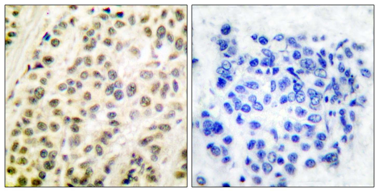 TFDP1 Antibody