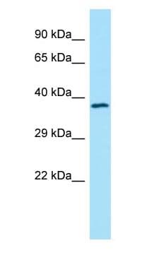 TMOD4 Antibody (aa156-205)