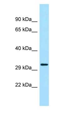 Polyclonal Rabbit anti-Rat PRKAB2 / AMPK Beta 2 Antibody (aa32-81, WB)