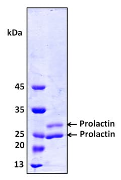 Human PRL / Prolactin Protein (Recombinant 8His, N-terminus)