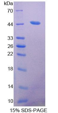 Mouse ACAT2 Protein (Recombinant His-S)