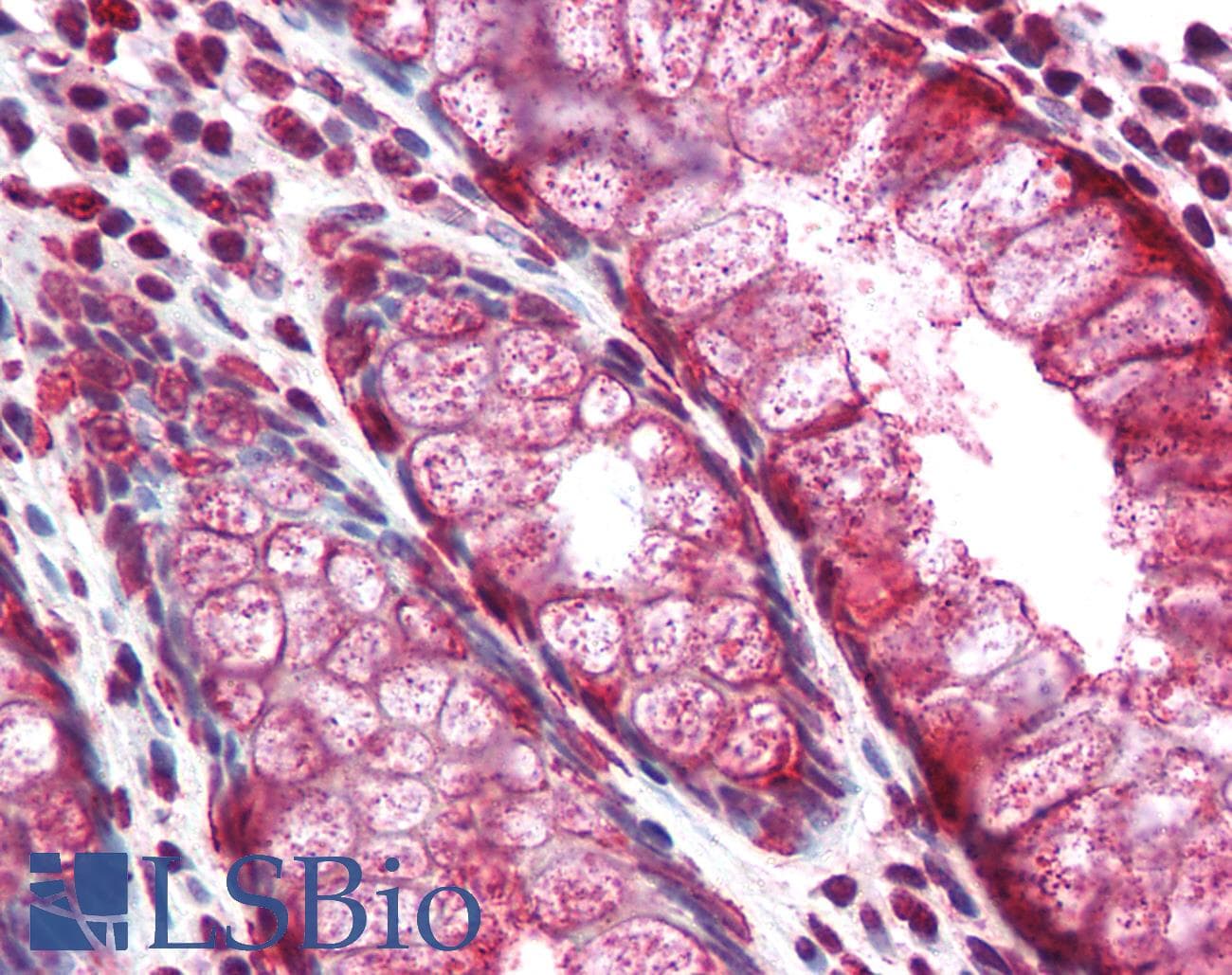 IHC-plus™ Monoclonal Mouse anti-Human Mucin 2 / MUC2 Antibody (clone 996/1, IHC, WB)