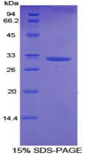 Rat DGKA Protein (Recombinant His-T7)