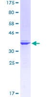 Human AML1 / RUNX1 Protein (Recombinant GST, N-terminus)