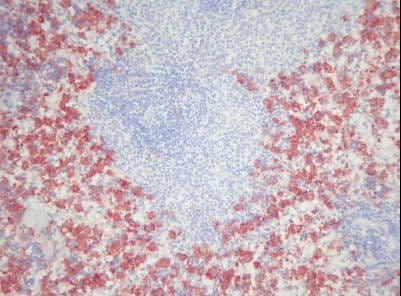 Macrophage Antibody (clone Ki-M2R)