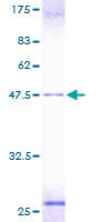 Human TCAP / Telethonin Protein (Recombinant GST)