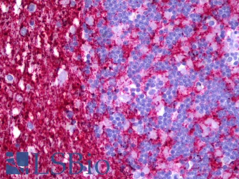 IHC-plus™ VDAC1 / PORIN Antibody (clone 2A8)