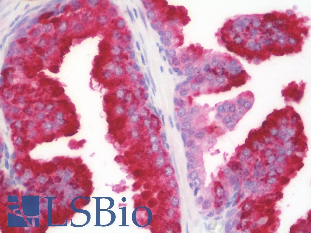 IHC-plus™ ACP5 / TRAP Antibody (aa75-101)