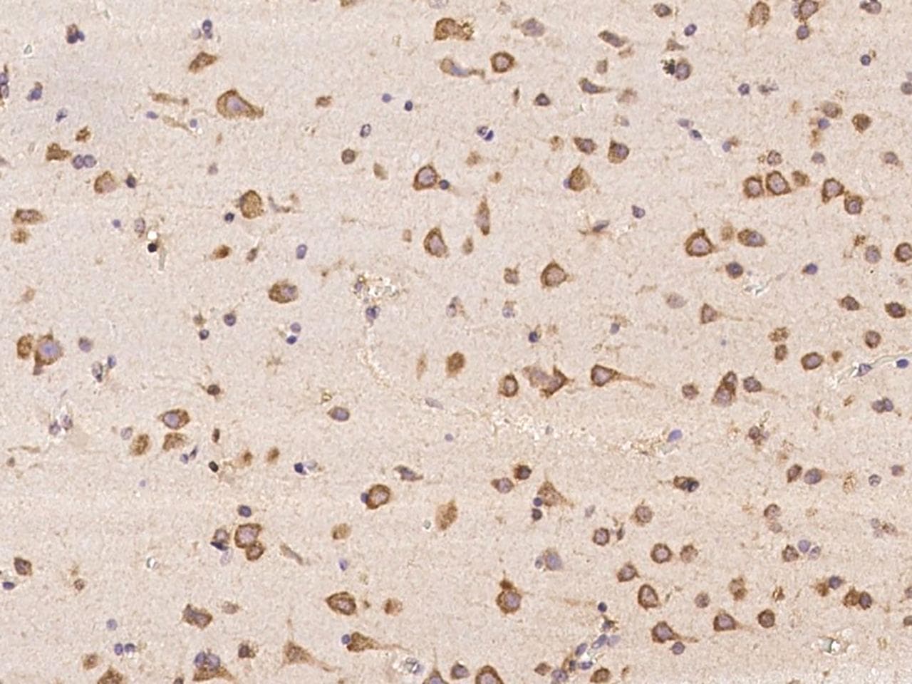 ABCA10 Antibody