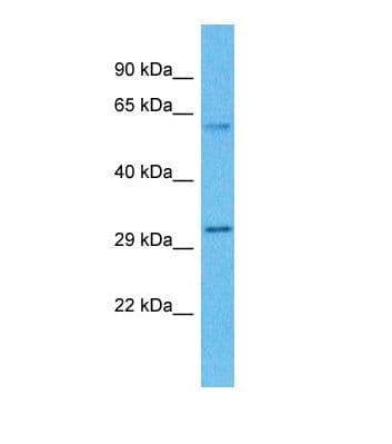 ZDHHC19 Antibody (aa48-97)