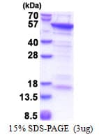 Human CUEDC1 Protein (Recombinant His)