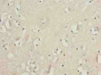 Polyclonal Rabbit anti-Human GLB1L2 Antibody (IHC)