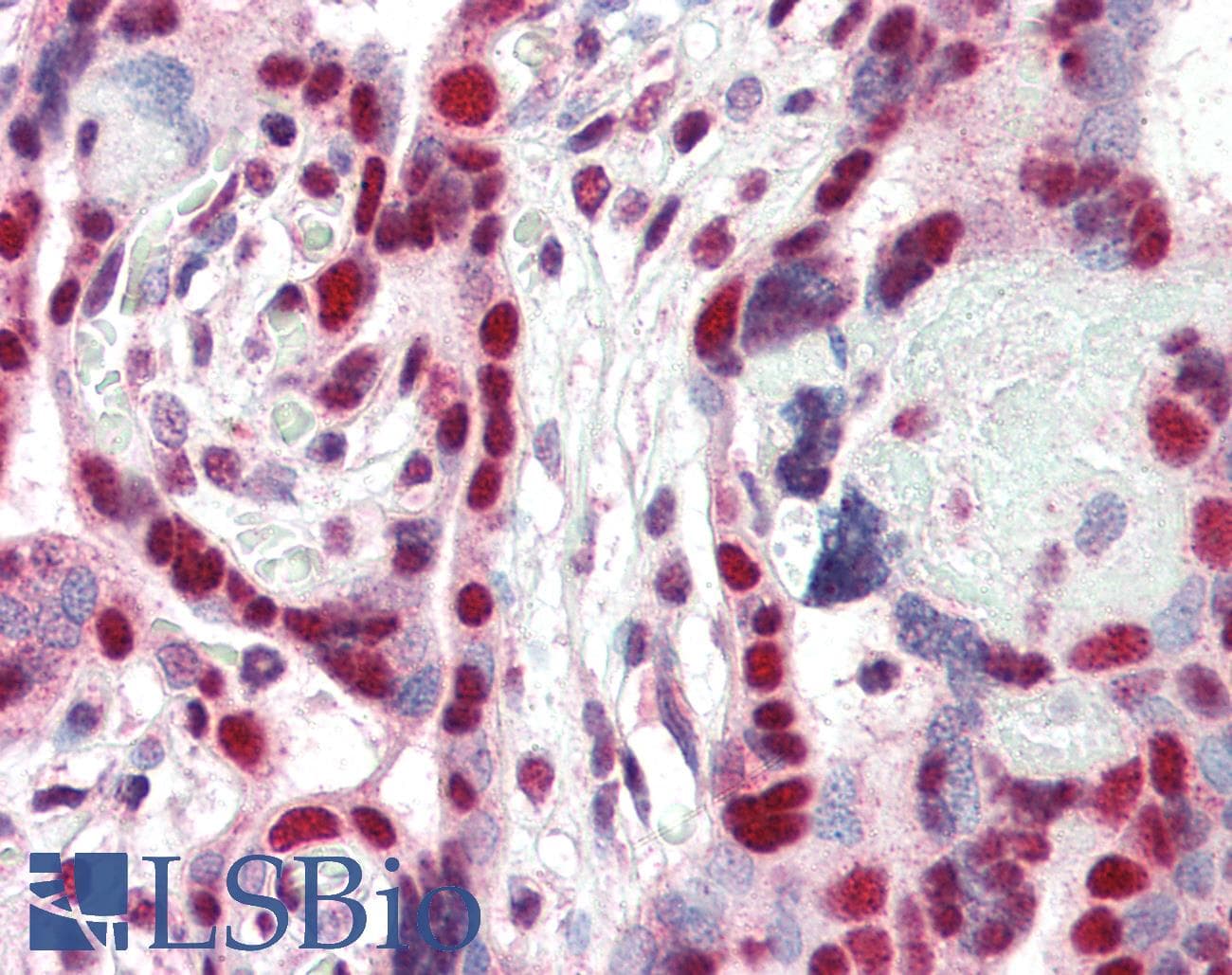 IHC-plus™ Polyclonal Goat anti-Human CBX3 / HP1 Gamma Antibody (aa74-87, IHC, WB)