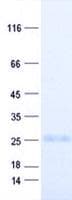 Human TM2D3 Protein (Recombinant His, N-Terminal)