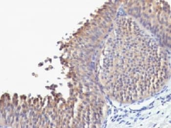 KRT10 / CK10 / Cytokeratin 10 Antibody (clone SPM623, Azide-free, BSA-free)