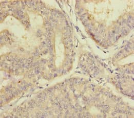 Polyclonal Rabbit anti-Human PLAA Antibody (IHC)