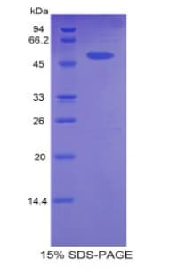 Rat CPT1A Protein (Recombinant His-GST)