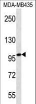 MYO1C Antibody