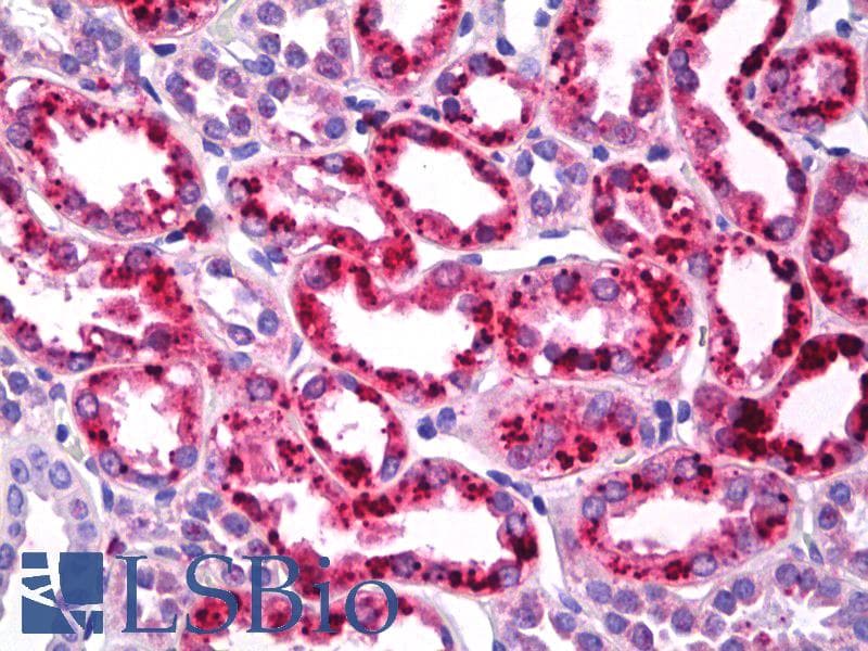 IHC-plus™ CLDN2 / Claudin 2 Antibody (C-Terminus)