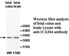 ICAM4 / CD242 Antibody (aa43-210)