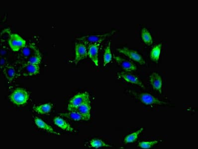 Polyclonal Rabbit anti-Human NRN1L Antibody