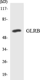 Spastic / GLRB Antibody (aa193-242)
