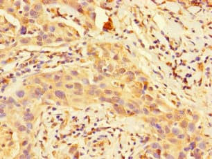 Polyclonal Rabbit anti-Human DSTN / Destrin Antibody
