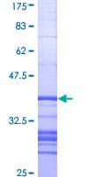 Human ALPL / Alkaline Phosphatase Protein (Recombinant GST, N-terminus)