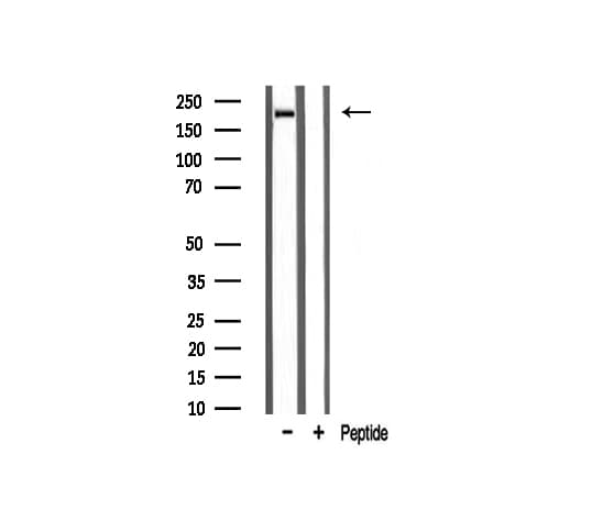 Sodium Channel Antibody