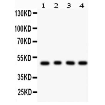 Polyclonal Rabbit anti-Human CTBP1 / CTBP Antibody (aa409-440, IHC, WB)