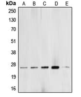 Polyclonal Rabbit anti-Human BCAS2 Antibody (C-Terminus, WB)