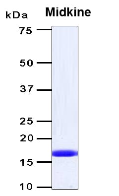 Human MDK / Midkine Protein (Recombinant 6His, N-terminus)