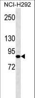 Monoclonal Mouse anti-Human JUP/CTNNG/Junction Plakoglobin Antibody (aa636-663, WB)