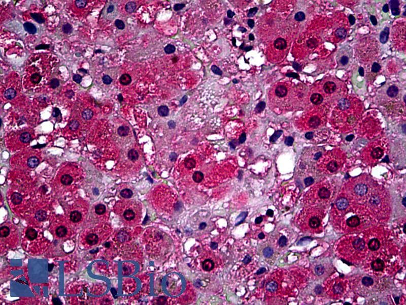 IHC-plus™ Monoclonal Mouse anti-Hamster ABCB1 / MDR1 / P Glycoprotein Antibody (clone F4, IHC, IF, WB)