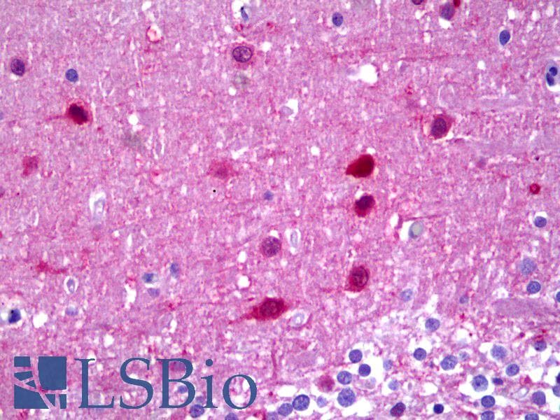 IHC-plus™ Monoclonal Rabbit anti-Human PRKCZ / PKC-Zeta Antibody (clone EP1490(2), Internal, IHC, WB)