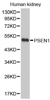 PSEN1 / Presenilin 1 Antibody
