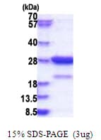 Human Amisyn / STXBP6 Protein (Recombinant His)