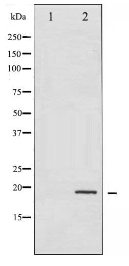 STMN1 / Stathmin / LAG Antibody (phospho-Ser24)