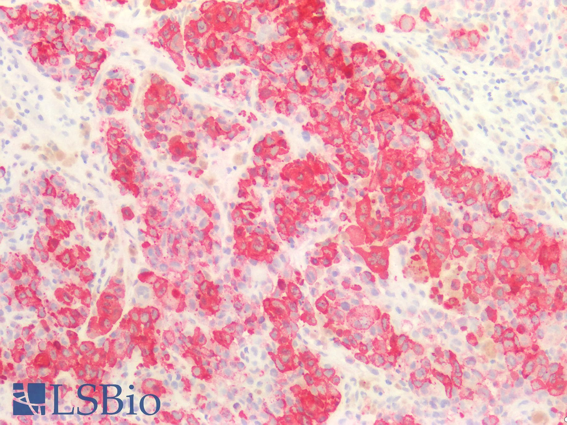Melanoma Antibody