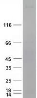 Human PLCE1 Protein (Recombinant Myc-DDK (Flag))