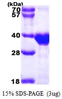 Human OTUB1 / OTU1 Protein (Recombinant His)
