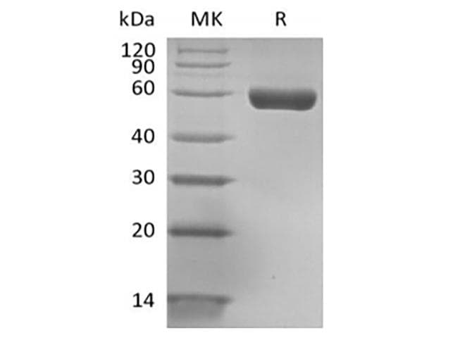 Human Hla-dqa1 gene (dqa1*0201, dqa1*03011 and dqa1*0303) Protein (Recombinant His-AVI, C-terminus)