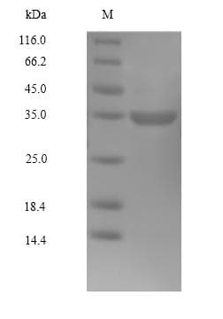 Human CDK4 Protein (Recombinant 6His, N-terminus)