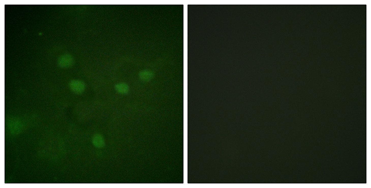NFAT5 Antibody (phospho-Ser1197)