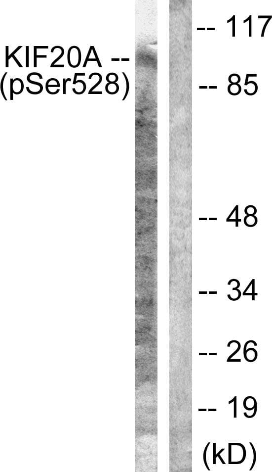 Polyclonal Rabbit anti-Human RAB6KIFL / KIF20A Antibody (phospho-Ser528, WB)