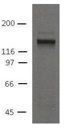 DSG2 / Desmoglein 2 Antibody (clone 10D2)