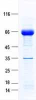 Human VTN / Vitronectin Protein (Recombinant His, N-Terminal)